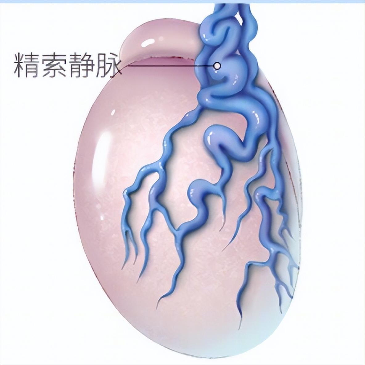 精子100%畸形能调理吗,精子畸形率100%能治疗吗