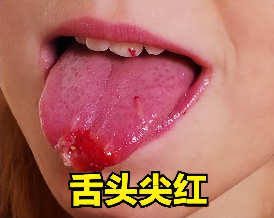 失眠舌头发涩是什么征兆,经常失眠舌苔白