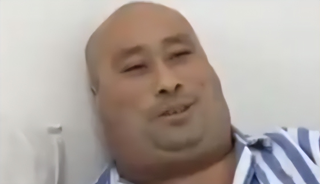 男子一年喝一千斤酒膀子像河马,男子喝酒脖子变河马脖