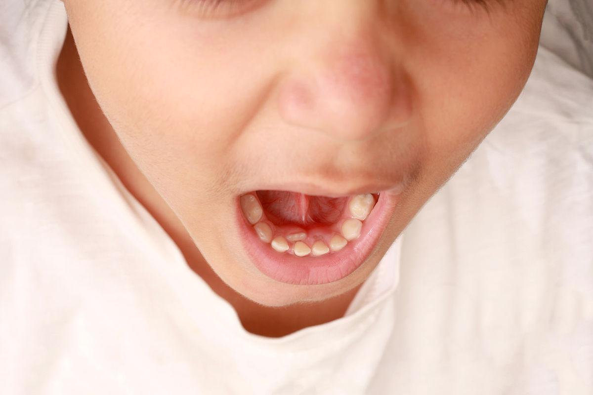 三种情况影响宝宝牙齿发育,婴儿牙齿问题及解决方法