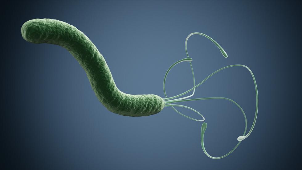 幽门螺杆菌感染阳性可以治好吗,幽门螺杆菌阳性是不是很严重