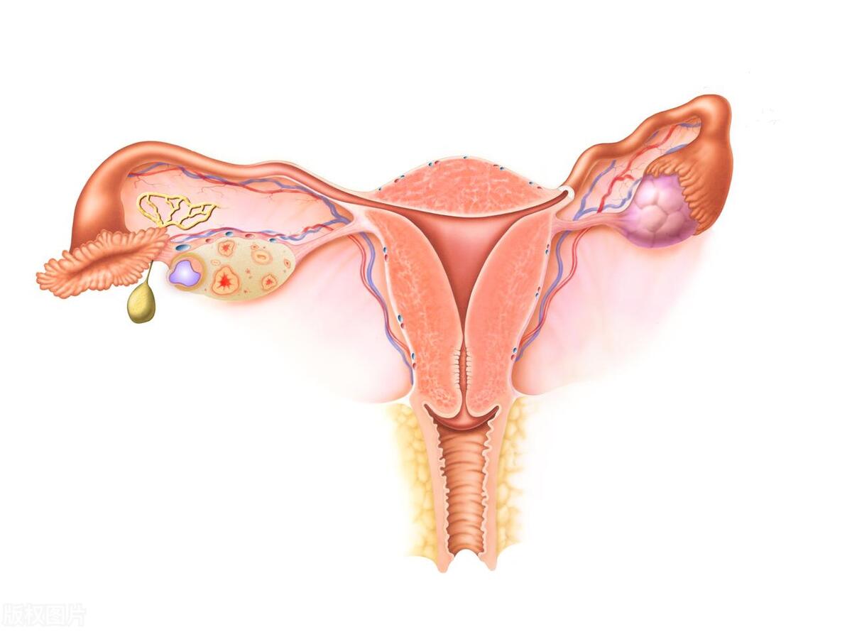 阴挺是怎么引起的,阴挺的主要病因是