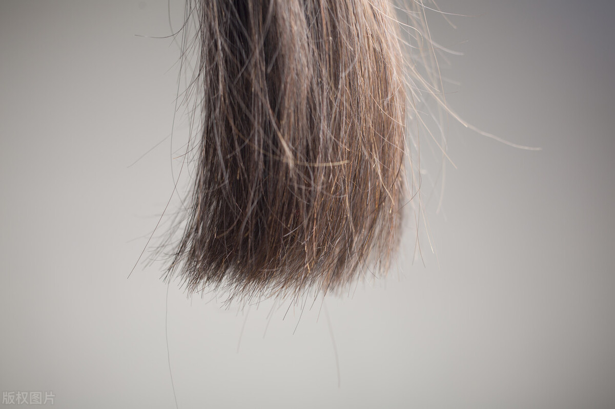 是什么导致毛发旺盛的,为什么身上的毛发比较旺盛