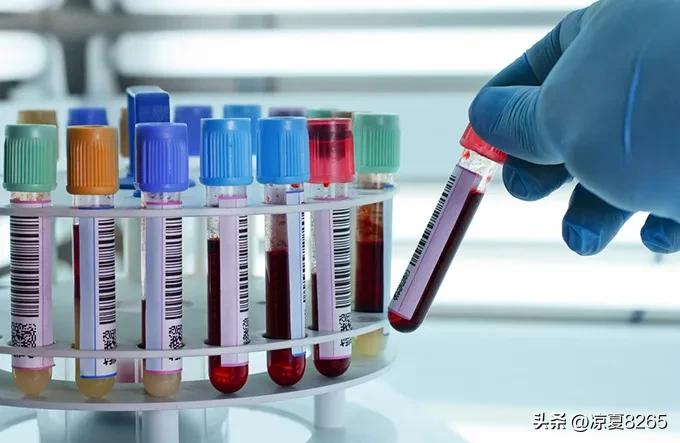 恐龙血型是个什么血型呢？