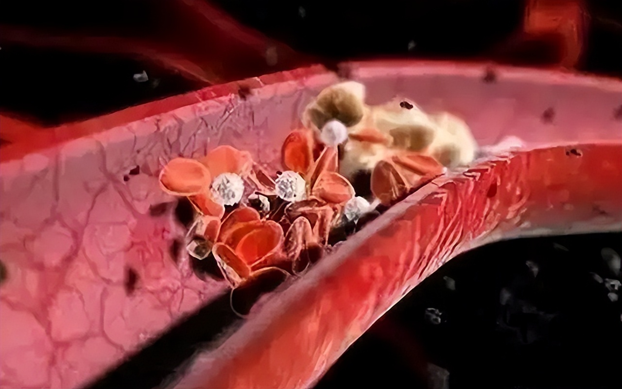 吃中药治过敏性紫癜还需吃维c吗,过敏性紫癜中药较好的配方是什么