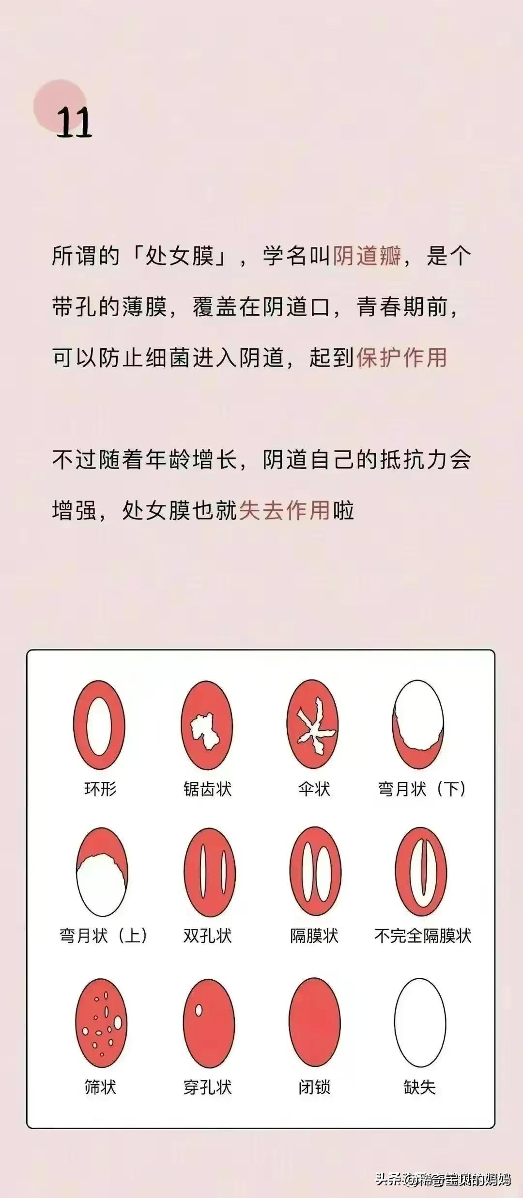 关于阴道，你必须知道的12个正经小知识！（漫画）