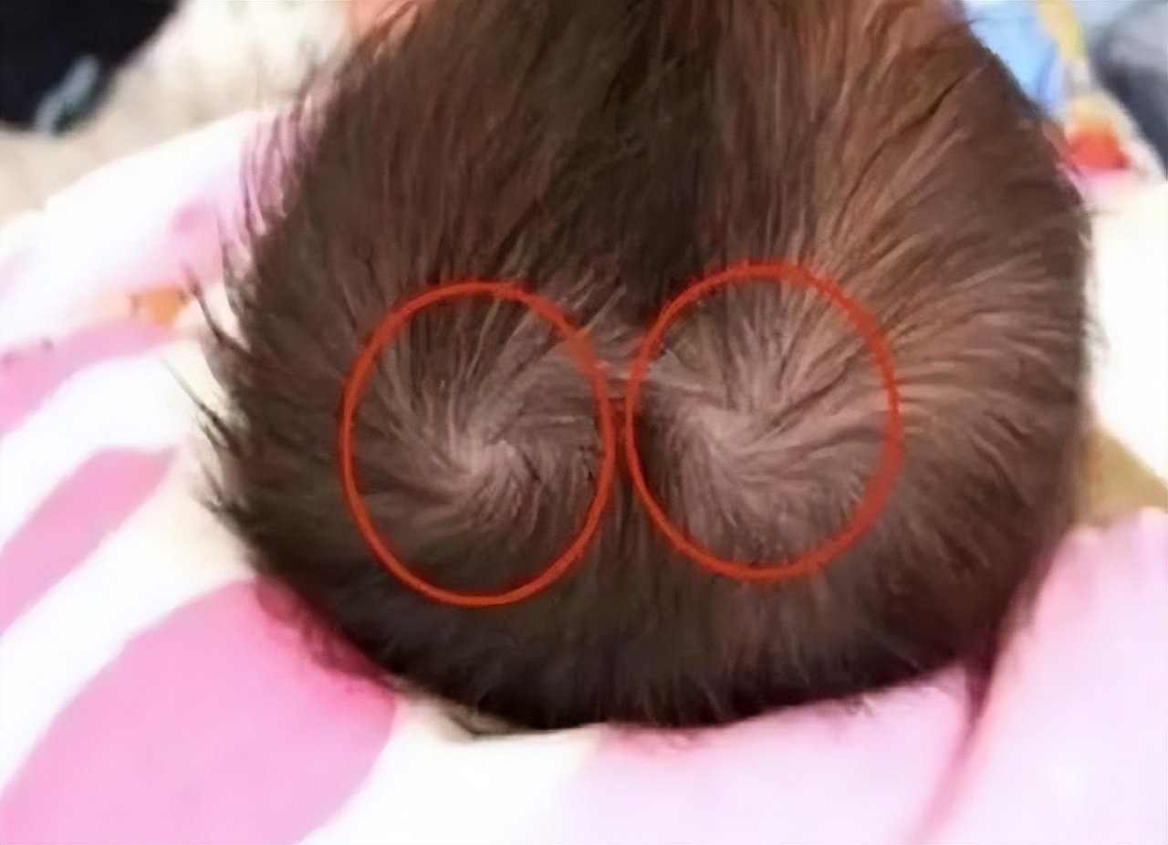 孩子头上的旋代表什么,小孩头顶的旋很重有什么寓意