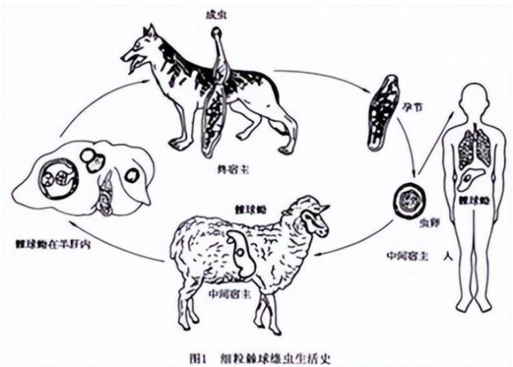 20岁女孩患虫癌死亡,少女患虫癌