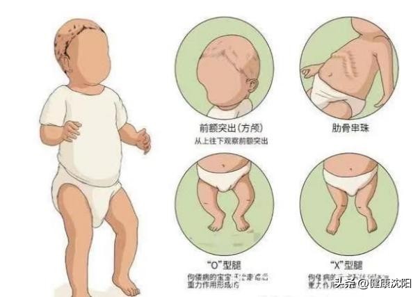 科普维生素d健康知识图片,健康科普关于维生素d你了解多少