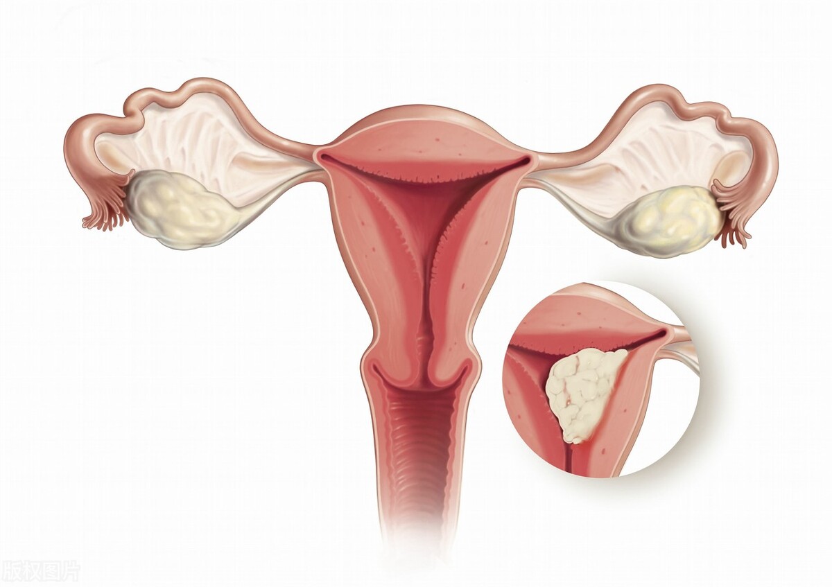 女性的阴道该怎么护理?医生:注意这5大细节,或可远离妇科疾病
