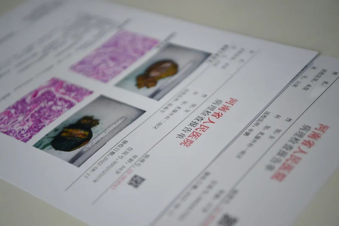 医生说病理报告有点小问题,病理报告没出来好害怕啊