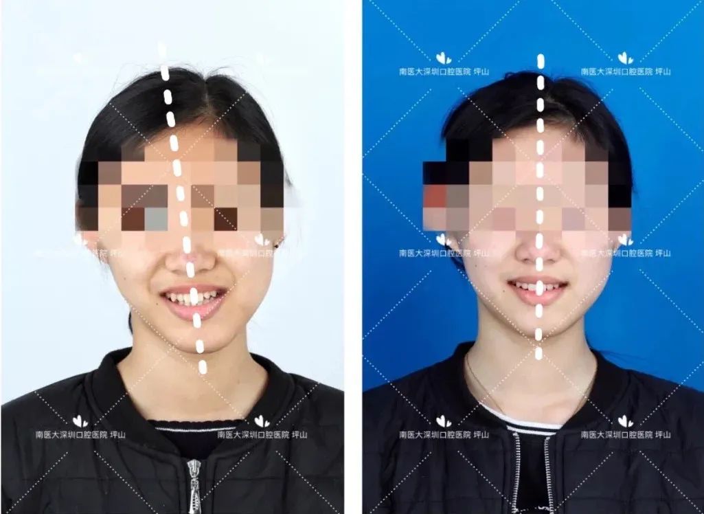 高考首日，深圳这家口腔医院笑着解出了最后“大题”：看牙难