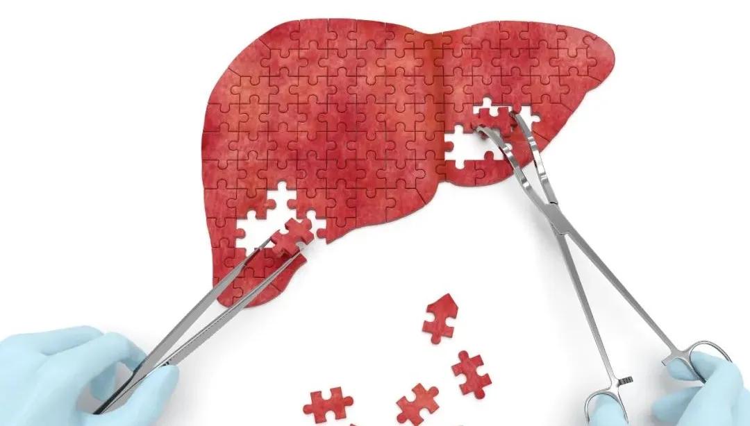 护肝最好的中成药治疗肝硬化,护肝促肝细胞再生