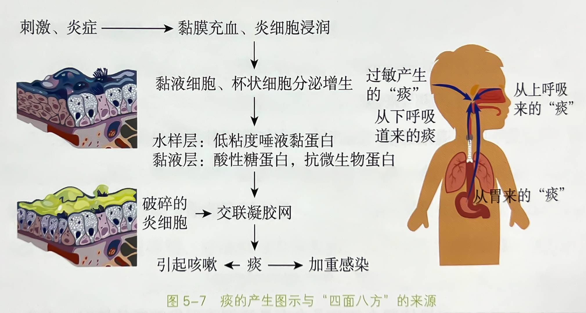 呼吸道感染有白痰用什么药,痰白粘稠上呼吸道感染症状