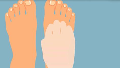 一走路脚指甲里疼怎么回事,一走路脚趾骨疼痛是什么原因呢