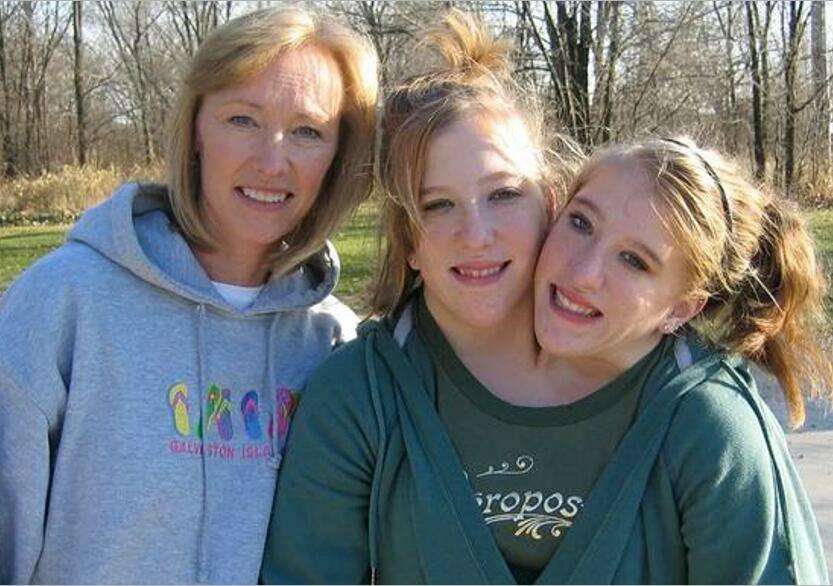 邦克兄弟连体人,连体人怎么进行生育