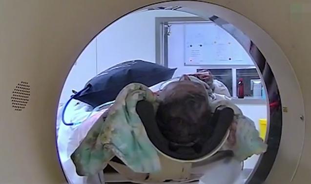 老伴老年痴呆的感人故事,老人脑梗感人故事