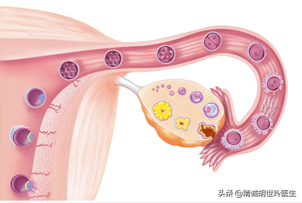 什么叫促排卵治疗综合评估,促排卵最佳方法有哪些