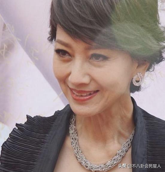 颈纹越来越多越来越显老怎么办,顽固又显老的颈纹