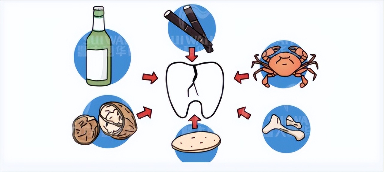 种植牙一般能用几年,种植牙一般能用几年最好呢