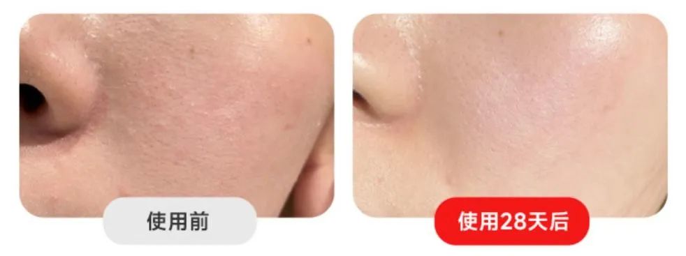 全网爆火的大牌灯美容仪到底有没有用？想变美的快看！附选购技巧