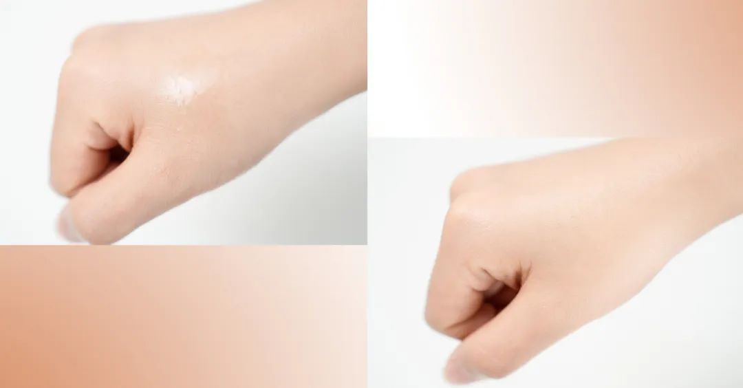 美肌试颜室‖直播见证，4周院线护肤的逆袭之路