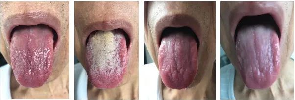 漫漫抗癌路最新消息,漫漫八年抗癌路