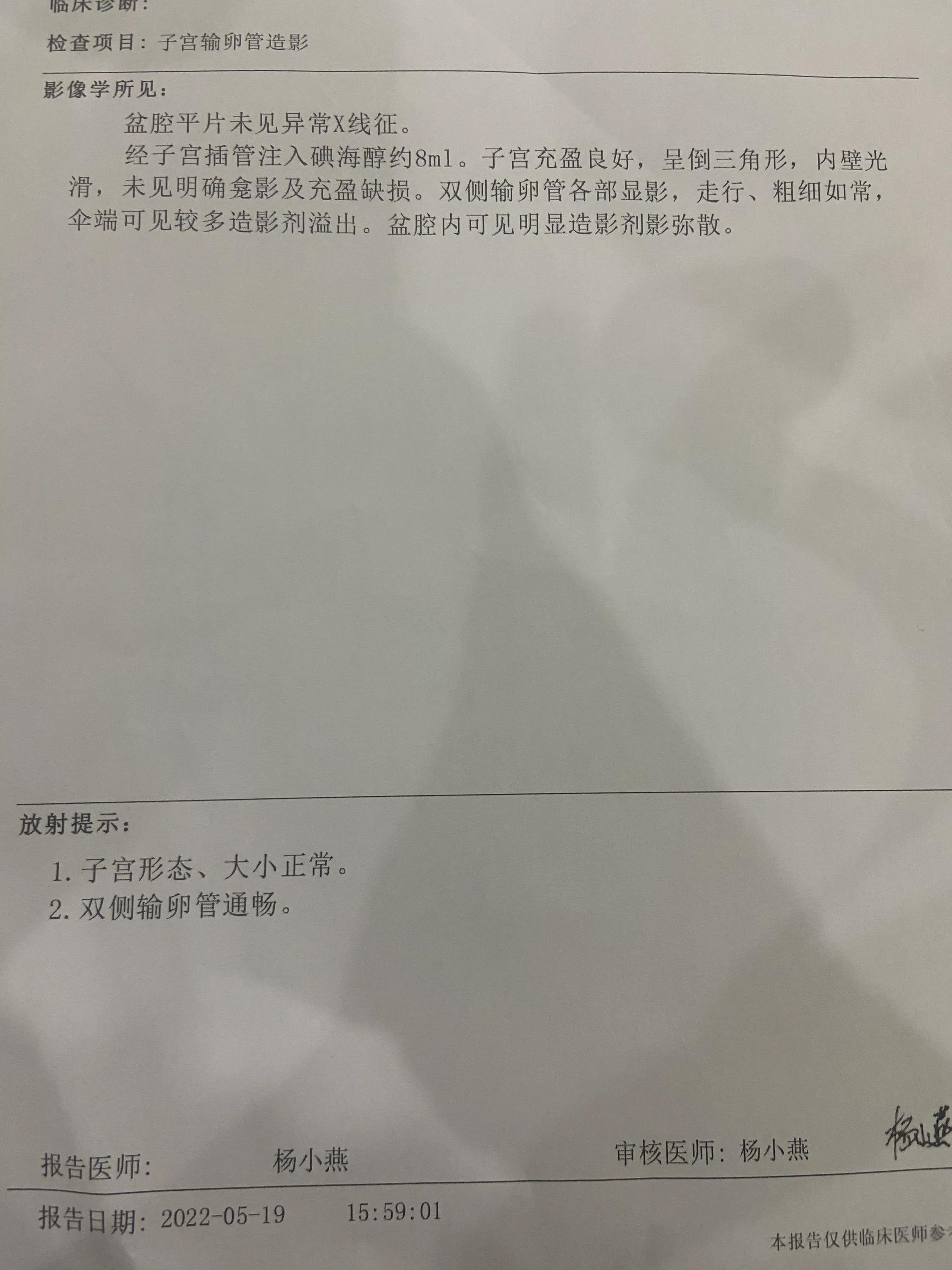 输卵管造影30mmx10mm,输卵管造影术后真实感受