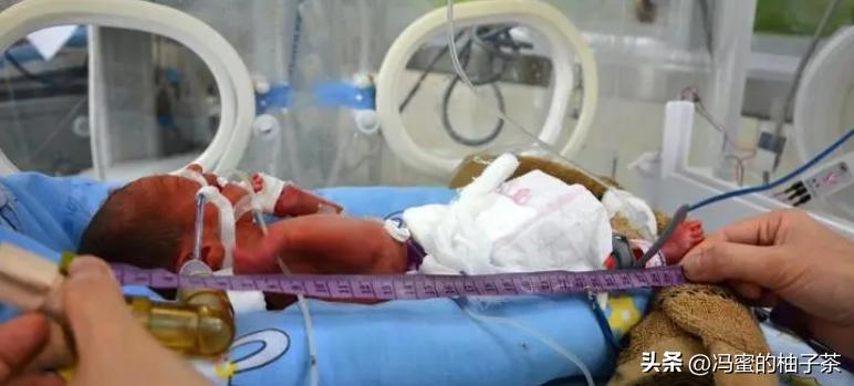 2009年湖南女子生下重2斤小猴子,湖南女子生了个小猴子上综艺节目