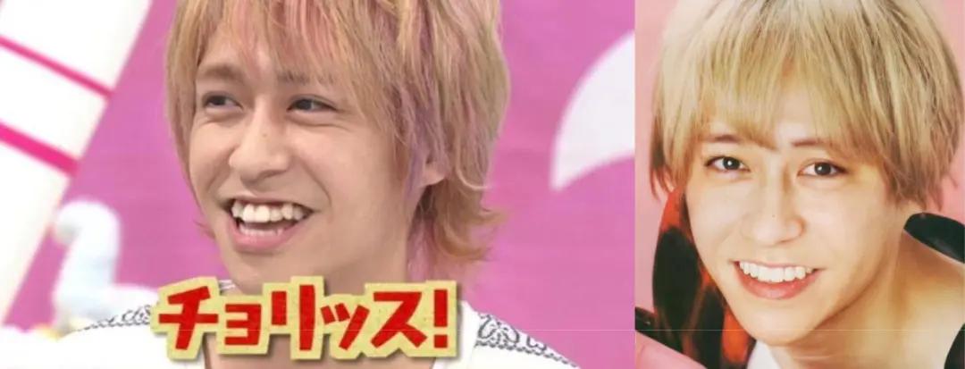 日本整牙的明星,日本整牙明星