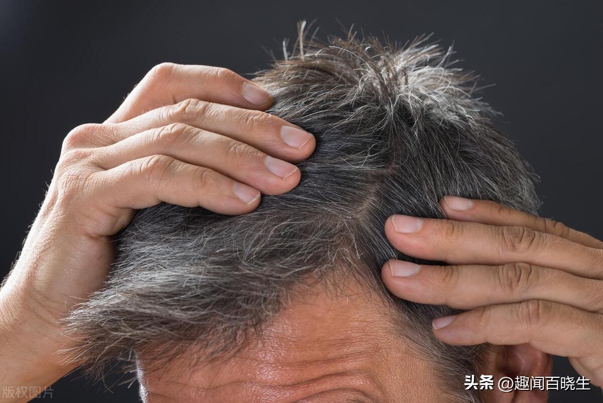 孕妇梦见自己头发白了是什么意思,梦见自己头发白了掉落是什么预兆