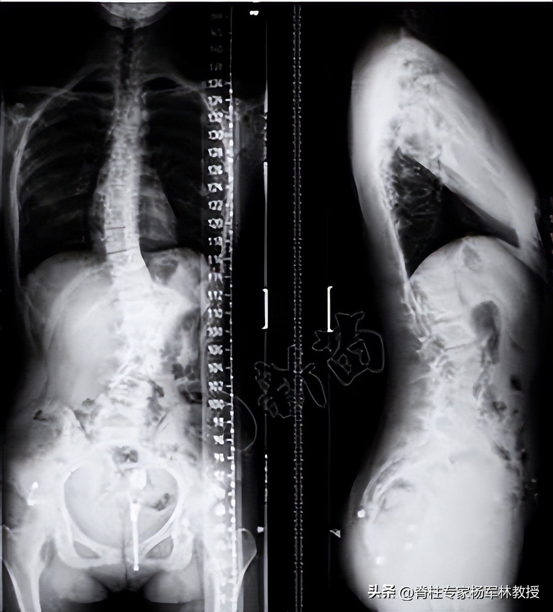 x光片不清晰是拍摄人员的问题吗,x光片可能会拍错吗