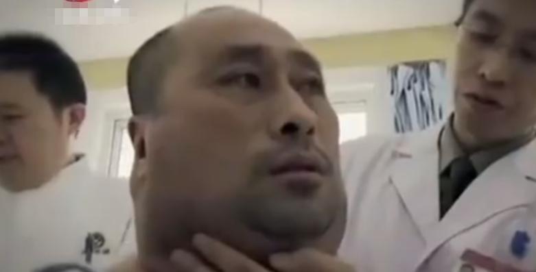 辽宁男子喝酒达三万斤,辽宁大叔40年喝成河马脖