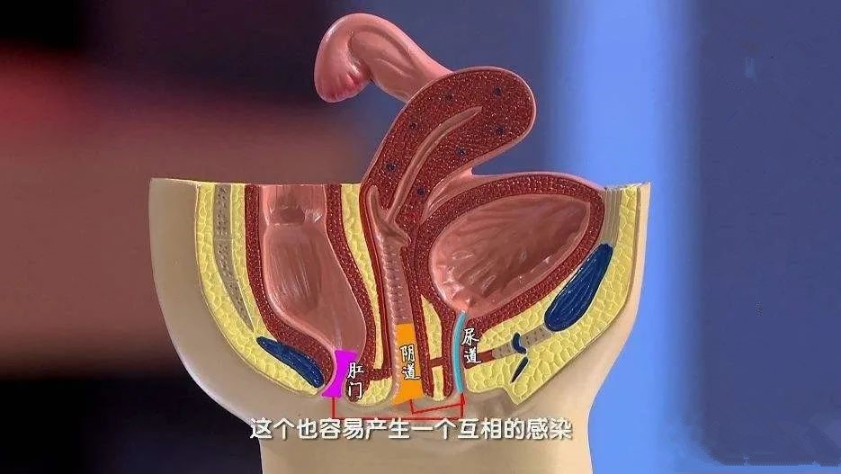 30岁的她做梦也没有想到，有一天竟会“为尿而痛”