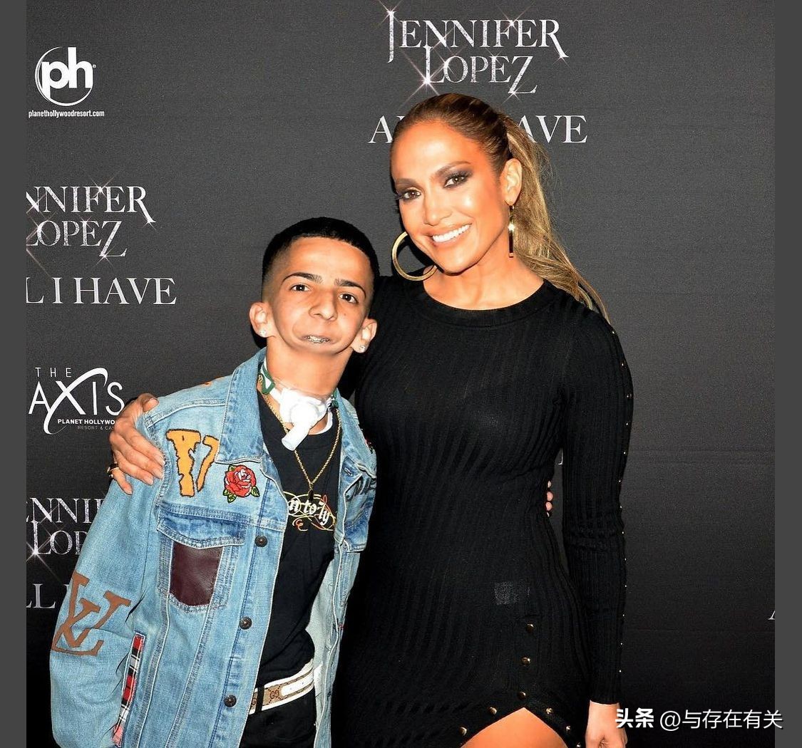 没有下巴的男人怎么改善,没有下巴的男人命运怎么样