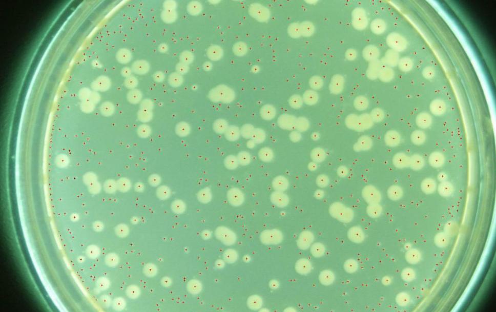 甲硝唑一瓶100片,甲硝唑一瓶100片和24粒哪个好