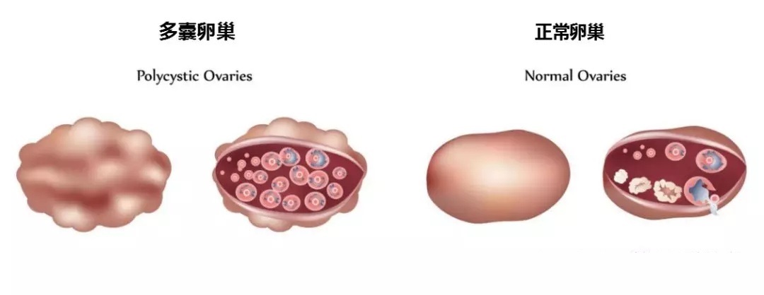 备孕期间药物导致的畸形概率,备孕期间拒绝乱用药怎么办