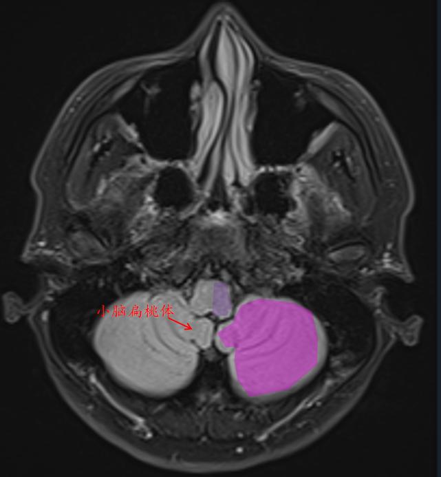 肘关节mri图谱大全,腕关节mri解剖图谱