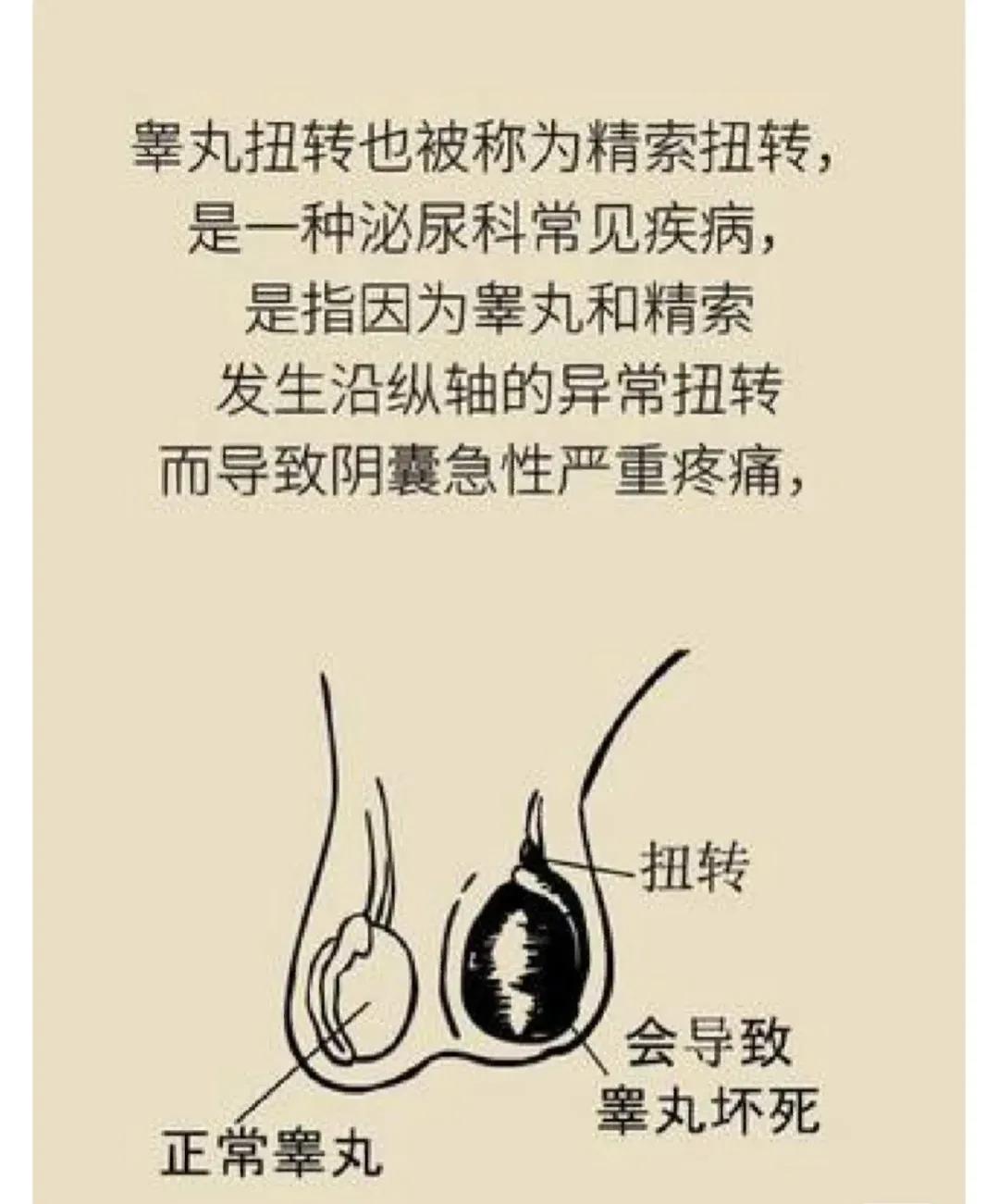 男性有哪些病不能怀孕,有六种病不需要治疗