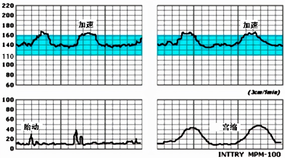 孕妈妈需要经历什么,从怀孕到生需要做多少次产检