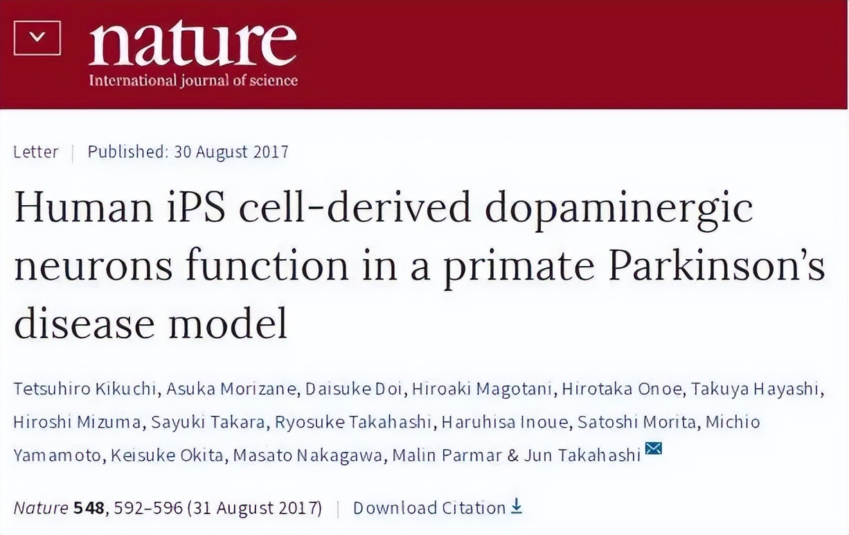 帕金森病自体干细胞治疗项目,间充质干细胞治疗帕金森病的效果