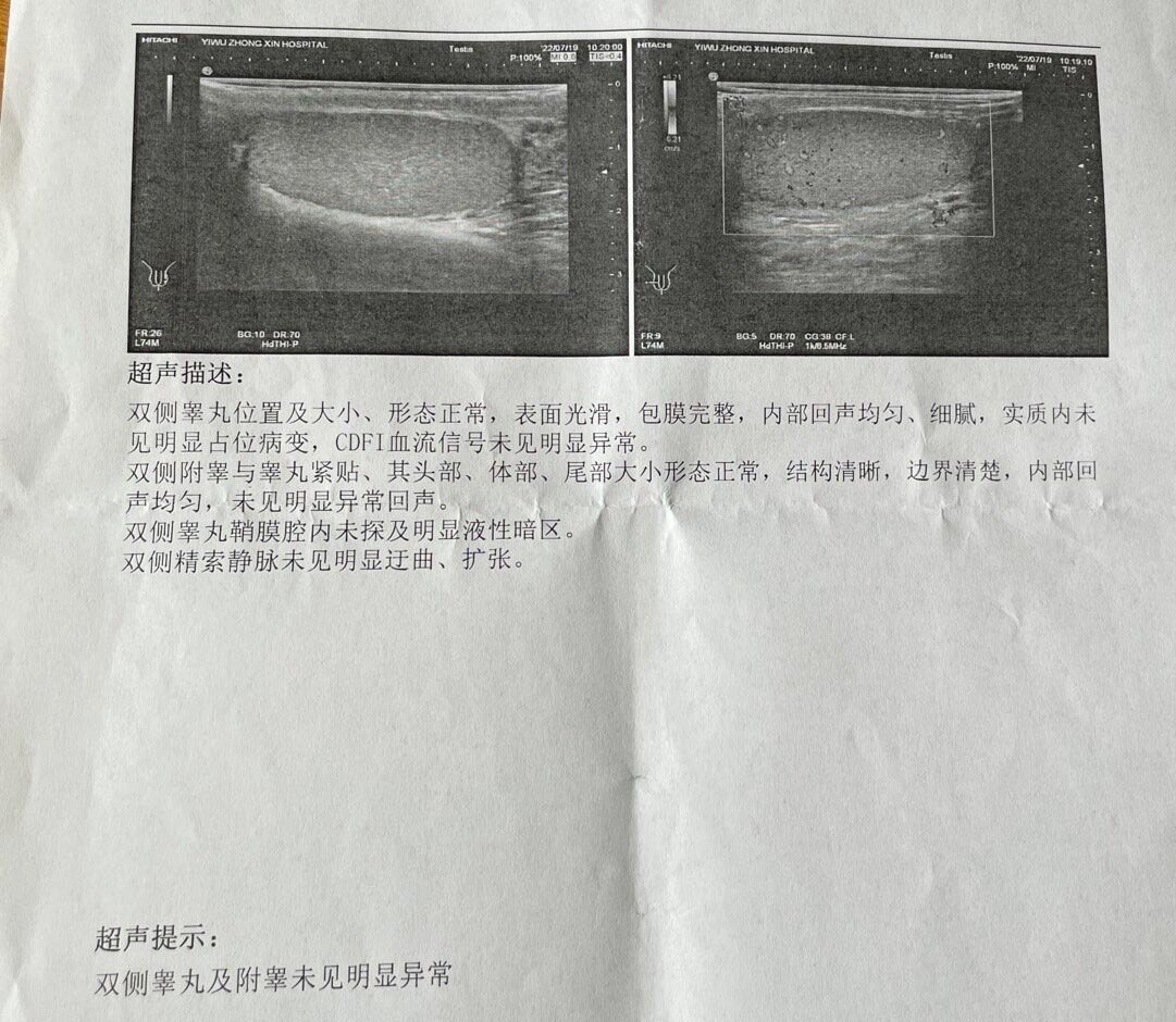 男方备孕二胎的备孕之路