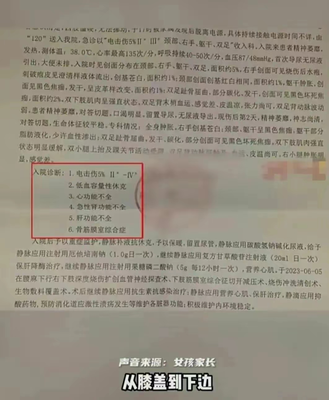 被电击女孩因脏器受损面临截肢,女孩充电时玩手机被电击面临截肢