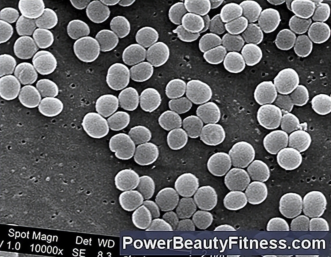 冬天头皮屑多又痒怎么回事,为啥一到冬天头皮屑多还痒