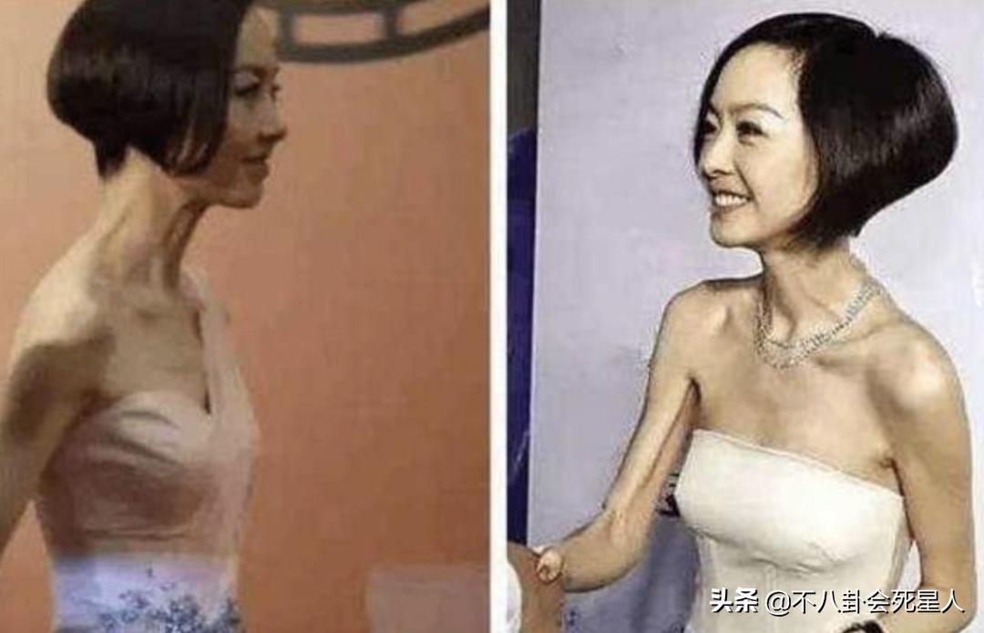 瘦脱相式衰老的7位女明星,瘦脱相的女孩子