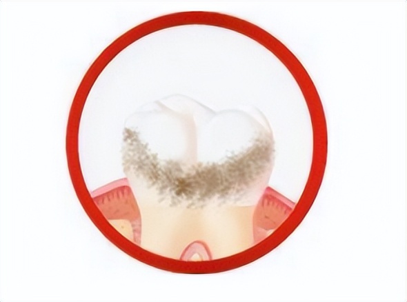 什么品牌的电动牙刷好测评,如何选择电动牙刷型号及价格