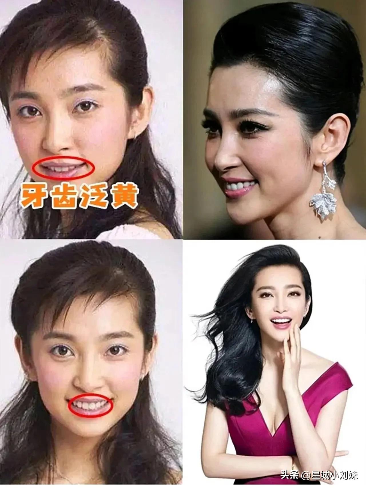 蔡徐坤前东家晒整形费用，整容花了70多万，做头发花了80多万