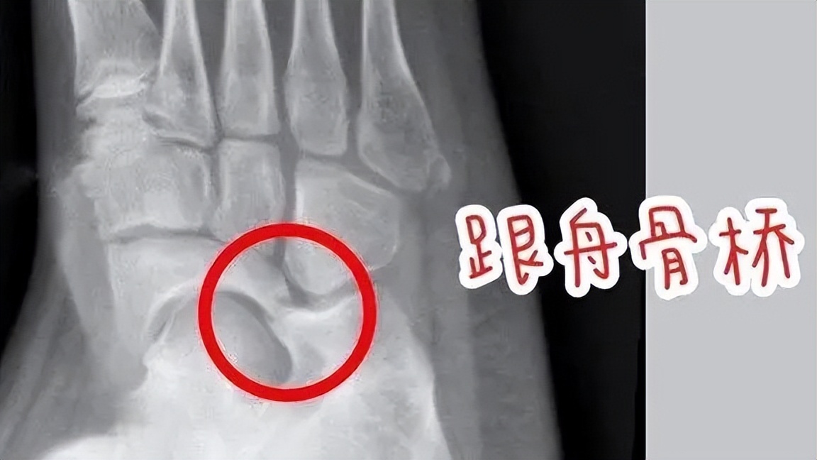 如何判断孩子足部有问题,儿童青少年的足部问题