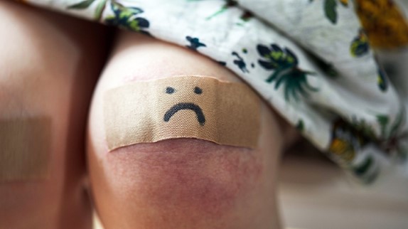 缝合后凹陷疤痕怎么修复儿童,儿童凹陷性疤痕彻底修复方法