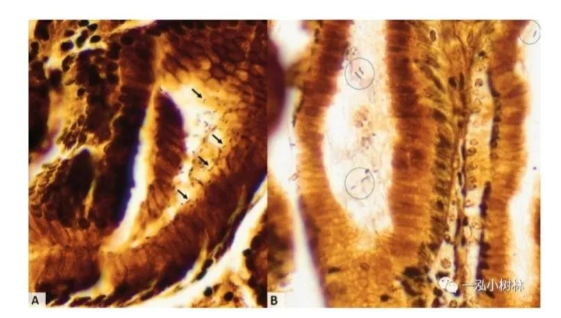 神秘果酸变甜原理,胃酸的发现史